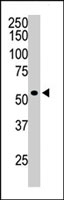 PAB2325 - HDAC1