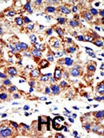 PAB2336 - HDAC8