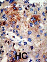 PAB2338 - HDAC9