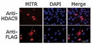 PAB2338 - HDAC9