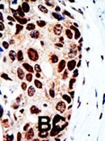 PAB2339 - HDAC9