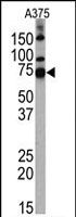 PAB2340 - HDAC10