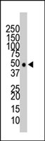 PAB2342 - HDAC11