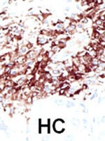 PAB2342 - HDAC11