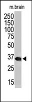 PAB2343 - HDAC11