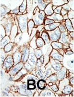 PAB2343 - HDAC11
