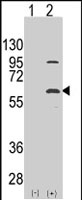 PAB2344 - ELP3