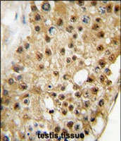 PAB2345 - ELP3