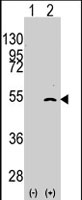 PAB2345 - ELP3