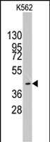 PAB2349 - MYST1