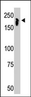 PAB2352 - NCOR1