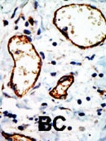 PAB2352 - NCOR1