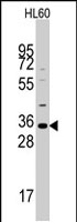 PAB2354 - MOGAT2