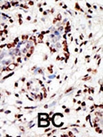 PAB2355 - MLL / HRX