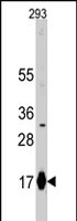 PAB2360 - IFITM3