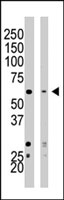 PAB2363 - SETD8 / SET07