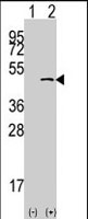 PAB2369 - SETD7 / SET9