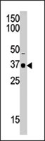 PAB2370 - SETD7 / SET9