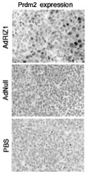 PAB2383 - PRDM2
