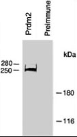 PAB2383 - PRDM2