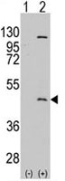 PAB2400 - PRMT8 / HRMT1L3
