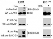 PAB2402 - SUMO1
