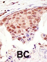PAB2402 - SUMO1
