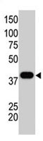 PAB2402 - SUMO1