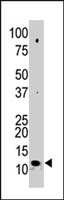 PAB2405 - SUMO2