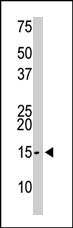 PAB2407 - SUMO2/3