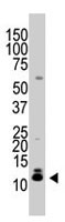 PAB2408 - SUMO2/3