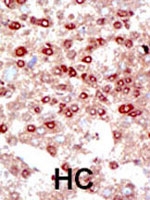 PAB2408 - SUMO2/3