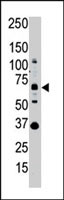 PAB2411 - SENP1
