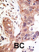PAB2411 - SENP1
