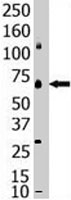 PAB2412 - SENP1
