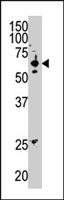 PAB2414 - SENP2