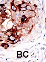 PAB2414 - SENP2