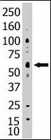 PAB2415 - SENP2