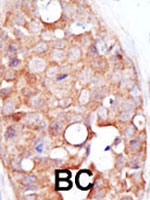 PAB2415 - SENP2