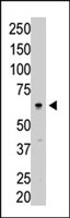 PAB2416 - SENP3