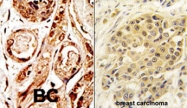 PAB2416 - SENP3