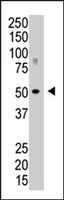 PAB2419 - SENP5