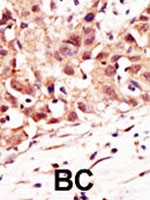 PAB2419 - SENP5
