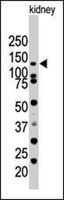 PAB2421 - SENP7