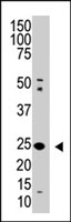PAB2423 - SENP8