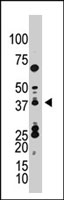 PAB2428 - SUMO4 / SMT3H4