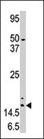 PAB2429 - SUMO4 / SMT3H4