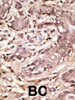 PAB2429 - SUMO4 / SMT3H4
