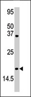 PAB2430 - SUMO4 / SMT3H4