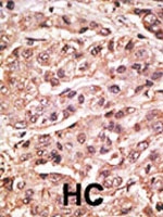 PAB2430 - SUMO4 / SMT3H4